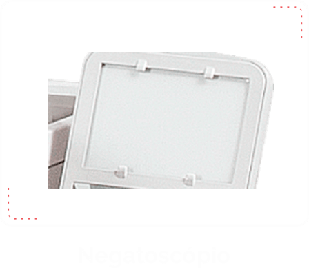 Negatoscopio